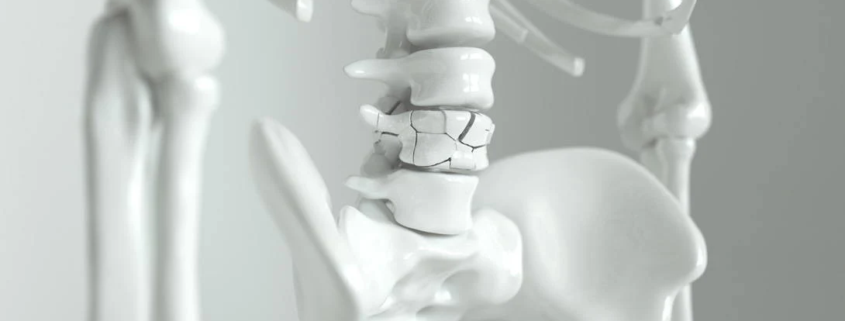osteoporosis and autoimmune disease, aiprecipecollection.com